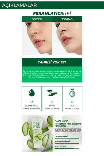 FOODAHOLIC Saf Organik Kore Aloe Vera Yatıştırıcı Soothing Jel Krem 100 ml görsel 4